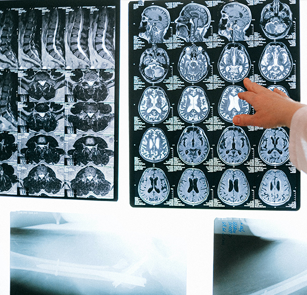 Medical imaging systems